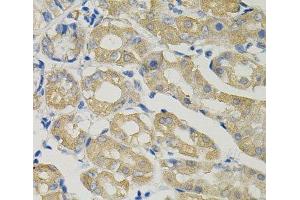 Immunohistochemistry of paraffin-embedded Human stomach using SLC30A1 Polyclonal Antibody (SLC30A1 抗体)