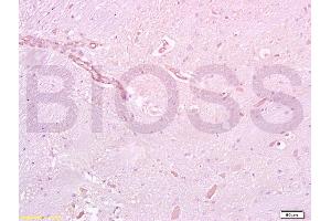 Formalin-fixed and paraffin embedded rat brain tissue labeled with Anti-GLP-1R Polyclonal Antibody, Unconjugated (ABIN731333) at 1:200 followed by conjugation to the secondary antibody and DAB staining (GLP1R 抗体  (AA 101-200))