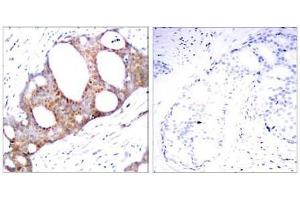 Image no. 1 for anti-Glycogen Synthase Kinase 3 alpha (GSK3a) (pSer21) antibody (ABIN196620) (GSK3 alpha 抗体  (pSer21))