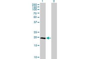 Western Blot analysis of IL23A expression in transfected 293T cell line by IL23A MaxPab polyclonal antibody. (IL23A 抗体  (AA 1-189))