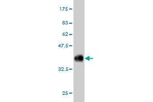 Western Blot detection against Immunogen (36. (COQ8A 抗体  (AA 1-100))