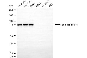 Western blotting analysis using forkhead box P1 antibody (ABIN7798650). (FOXP1 抗体)