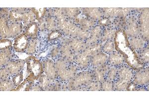 Detection of ATP1a1 in Human Kidney Tissue using Monoclonal Antibody to ATPase, Na+/K+ Transporting Alpha 1 Polypeptide (ATP1a1)