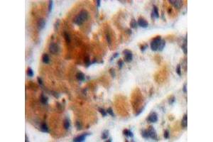 Used in DAB staining on fromalin fixed paraffin-embedded Stomach tissue (MUC4 抗体  (AA 1154-1309))