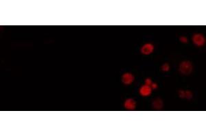 ABIN6274505 staining Hela cells by IF/ICC.