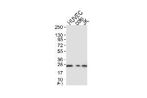 Western blot analysis of extracts from HUVEC cells (Lane 1), colo cells (Lane 2) and JK cells (Lane 3), using Caveolin-1 Antibody. (Caveolin-1 抗体)
