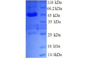 Transmembrane Emp24 Protein Transport Domain Containing 9 (TMED9) (AA 40-197), (partial) protein (GST tag) (TMED9 Protein (AA 40-197, partial) (GST tag))