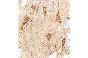 Immunohistochemical analysis of paraffin-embedded H. (VAMP8 抗体  (N-Term))