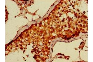 Immunohistochemistry of paraffin-embedded human testis tissue using ABIN7149691 at dilution of 1:100
