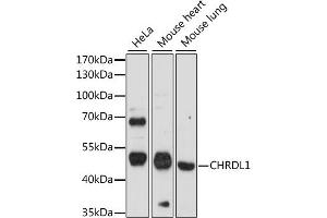 Western blot analysis of extracts of various cell lines, using CHRDL1 antibody (ABIN7266351) at 1:1000 dilution. (CHRDL1 抗体  (AA 289-458))