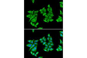 Immunofluorescence (IF) image for anti-Uroporphyrinogen Decarboxylase (UROD) antibody (ABIN1876681) (UROD 抗体)