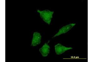 Immunofluorescence of purified MaxPab antibody to SIP1 on HeLa cell. (SIP1 抗体  (AA 1-280))