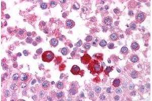 Human Testis (formalin-fixed, paraffin-embedded) stained with CHEK2 antibody ABIN213921 at 5 ug/ml followed by biotinylated goat anti-rabbit IgG secondary antibody ABIN481713, alkaline phosphatase-streptavidin and chromogen. (CHEK2 抗体  (N-Term))