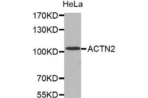 Western Blotting (WB) image for anti-Actinin, alpha 2 (ACTN2) (AA 1-250) antibody (ABIN1678557) (ACTN2 抗体  (AA 1-250))