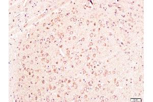 Paraformaldehyde-fixed, paraffin embedded rat brain tissue, Antigen retrieval by boiling in sodium citrate buffer(pH6) for 15min, Block endogenous peroxidase by 3% hydrogen peroxide for 30 minutes, Blocking buffer (normal goat serum) at 37°C for 20min, Antibody incubation with Rabbit Anti-Neuroglycan Polyclonal Antibody, Unconjugated  at 1:300 overnight at 4°C, followed by a conjugated secondary and DAB staining (CSPG5 抗体  (AA 351-450))