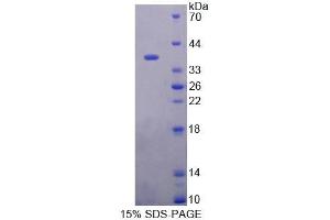 SDS-PAGE analysis of Rat RGN Protein. (Regucalcin Protein (RGN))