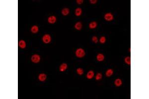 ABIN6266657 staining COS7 by IF/ICC. (SENP5 抗体)