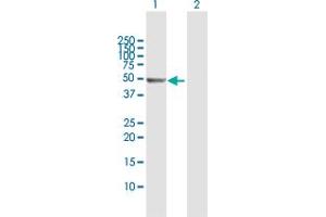 Western Blotting (WB) image for anti-Proteasome (Prosome, Macropain) 26S Subunit, Non-ATPase, 5 (PSMD5) (AA 1-504) antibody (ABIN950150)