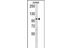 Western blot analysis of anti-Dnmt3a Antibody (N-term R46) (ABIN387883 and ABIN2844094) in Jurkat cell line lysates (35 μg/lane). (DNMT3A 抗体  (N-Term))