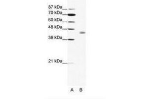 Image no. 1 for anti-LIM Domain Binding 2 (LDB2) (C-Term) antibody (ABIN202367) (LIM Domain Binding 2 Protein 抗体  (C-Term))