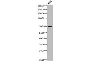 Western Blot analysis of K562 cells using Acetyl-p73 (K321) Polyclonal Antibody (Tumor Protein p73 抗体  (acLys321))