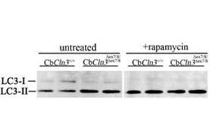 Immunoblots for LC3 protein (LC3B Antibody ) are shown for extracts from untreated or rapamycin-treated (250 nM, 4 h) cultures of wild-type (CbCln3+/+) or homozygous cerebellar cells (CbCln3Äex7/8/Äex7/8). (LC3B 抗体  (N-Term))