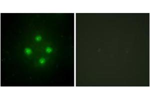Immunofluorescence analysis of HuvEc cells, using MED24 Antibody. (MED24 抗体  (AA 801-850))