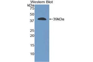 Western blot analysis of the recombinant protein. (CPB1 抗体  (AA 109-415))