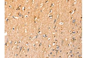 The image on the left is immunohistochemistry of paraffin-embedded Human brain tissue using ABIN7192442(SLC25A3 Antibody) at dilution 1/35, on the right is treated with synthetic peptide. (SLC25A3 抗体)