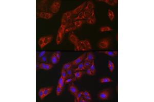 Immunofluorescence analysis of U-2 OS cells using FBP1 Rabbit pAb (ABIN6130385, ABIN6140501, ABIN6140502 and ABIN6221054) at dilution of 1:100 (40x lens). (FBP1 抗体  (AA 1-338))