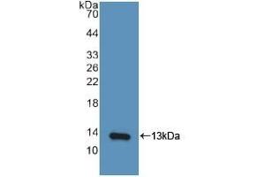 Detection of Recombinant IP10, Human using Polyclonal Antibody to Interferon Gamma Induced Protein 10 kDa (IP10) (CXCL10 抗体  (AA 22-98))