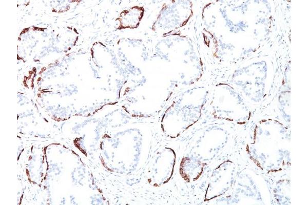 Cytokeratin 2 抗体