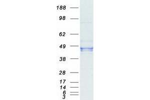 Validation with Western Blot