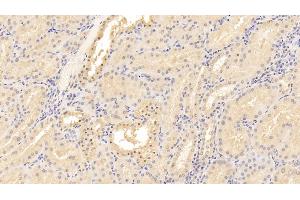 Detection of CD40L in Human Kidney Tissue using Monoclonal Antibody to Cluster Of Differentiation 40 Ligand (CD40L) (CD40 Ligand 抗体  (AA 48-244))