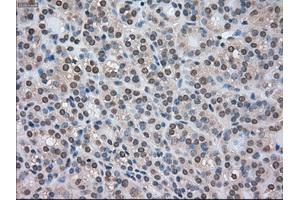 Immunohistochemical staining of paraffin-embedded Carcinoma of kidney tissue using anti-CTAG1Bmouse monoclonal antibody. (CTAG1B 抗体)