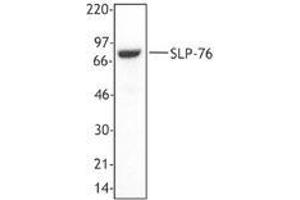 Image no. 1 for anti-Lymphocyte Cytosolic Protein 2 (SH2 Domain Containing Leukocyte Protein of 76kDa) (LCP2) (AA 216-434) antibody (ABIN230462) (LCP2 抗体  (AA 216-434))