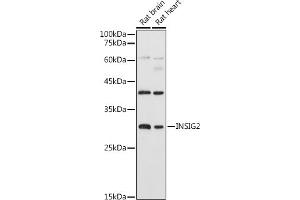 Western blot analysis of extracts of various cell lines, using INSIG2 antibody (ABIN7267888) at 1:1000 dilution. (INSIG2 抗体  (AA 50-150))