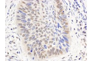 Immunohistochemistry (IHC) image for anti-E1A Binding Protein P300 (EP300) (AA 1000-1050) antibody (ABIN7454617)