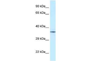 Western Blotting (WB) image for anti-Nudix (Nucleoside Diphosphate Linked Moiety X)-Type Motif 6 (NUDT6) (Middle Region) antibody (ABIN2789004)