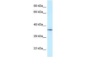 WB Suggested Anti-NUDT6 Antibody Titration: 1. (NUDT6 抗体  (Middle Region))