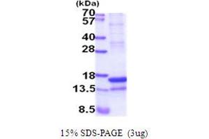 SDS-PAGE (SDS) image for Regenerating Islet-Derived Family, Member 4 (REG4) (AA 23-158) protein (His tag) (ABIN5854108) (REG4 Protein (AA 23-158) (His tag))