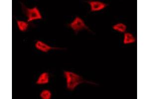 ABIN6266909 staining HT29 by IF/ICC. (TUBGCP5 抗体  (Internal Region))