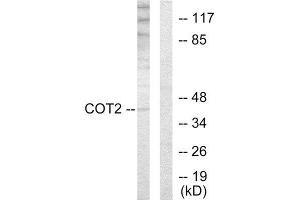 Western Blotting (WB) image for anti-Grr1p (GRR1) (N-Term) antibody (ABIN1849262) (Grr1p 抗体  (N-Term))