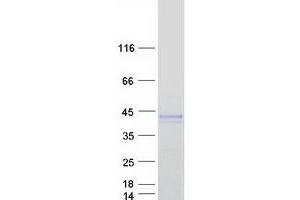 Validation with Western Blot