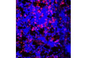 Immunofluorescence of paraffin embedded mouse bone using CD177 (ABIN7073372) at dilution of 1:500 (400x lens) (CD177 抗体)