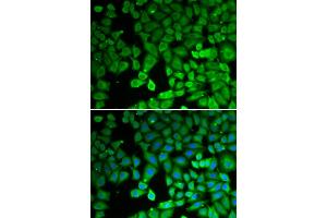 Immunofluorescence analysis of U2OS cells using NR4A1 antibody (ABIN6293398). (NR4A1 抗体)