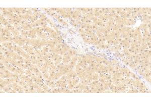 Immunohistochemistry (IHC) image for anti-General Transcription Factor IIH, Polypeptide 1, 62kDa (GTF2H1) (AA 84-335) antibody (ABIN7442894)