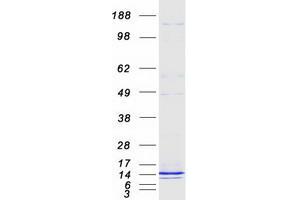 Validation with Western Blot