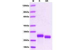 2 μg of IL-6, Mouse was resolved with SDS-PAGE under reducing (R) and non-reducing (N) conditions and visualized by Coomassie Blue staining. (IL-6 Protein (AA 25-211) (His tag))