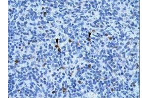 Image no. 1 for anti-Annexin A3 (ANXA3) (N-Term) antibody (ABIN202243) (Annexin A3 抗体  (N-Term))